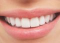 white teeth