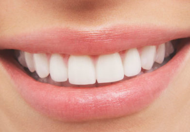 दातों को रखें सेहतमंद और चमकीला 1 white teeth