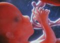 82070988 downp6800135 foetus aged 12 weeks spl