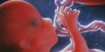 82070988 downp6800135 foetus aged 12 weeks spl