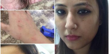 उबर कैब में महिला पत्रकार के साथ बदसलूकी शिकायत दर्ज