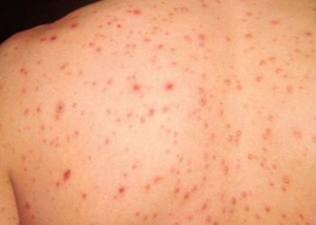 image 750x 5b2d2683cb5c2