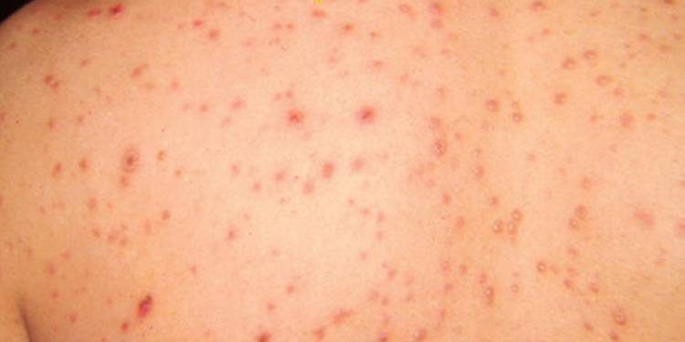 image 750x 5b2d2683cb5c2