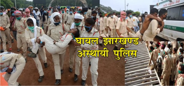 अस्थायी पुलिस पर स्थायी भयंकर लाठी चार्ज 1 police